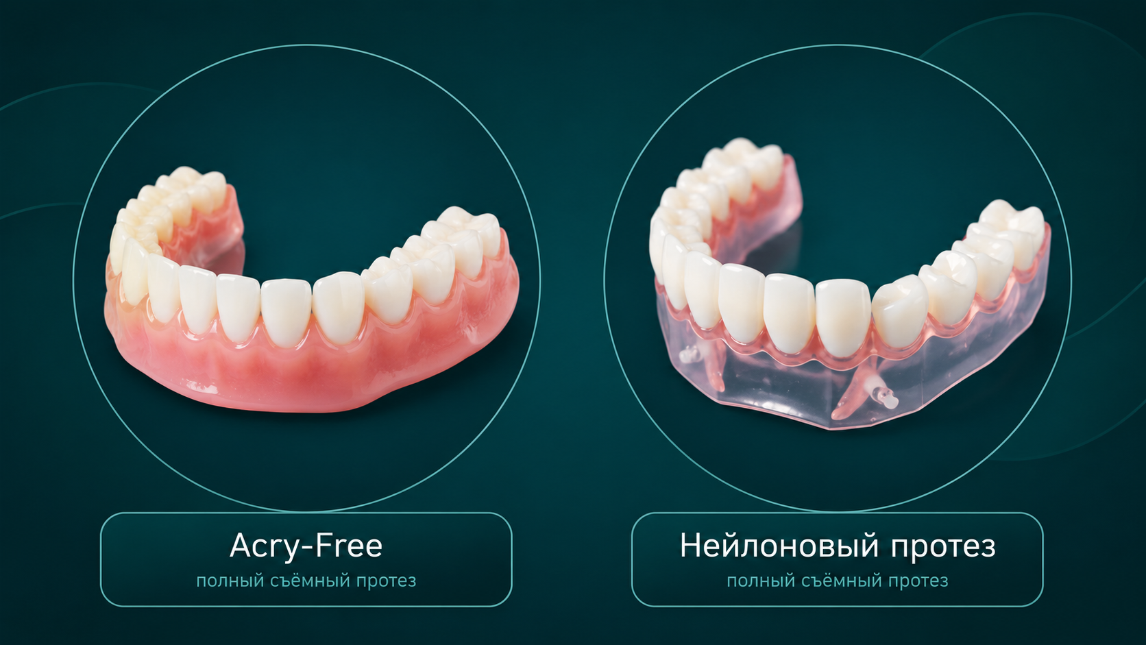 Съемные протезы при полной потере зубов