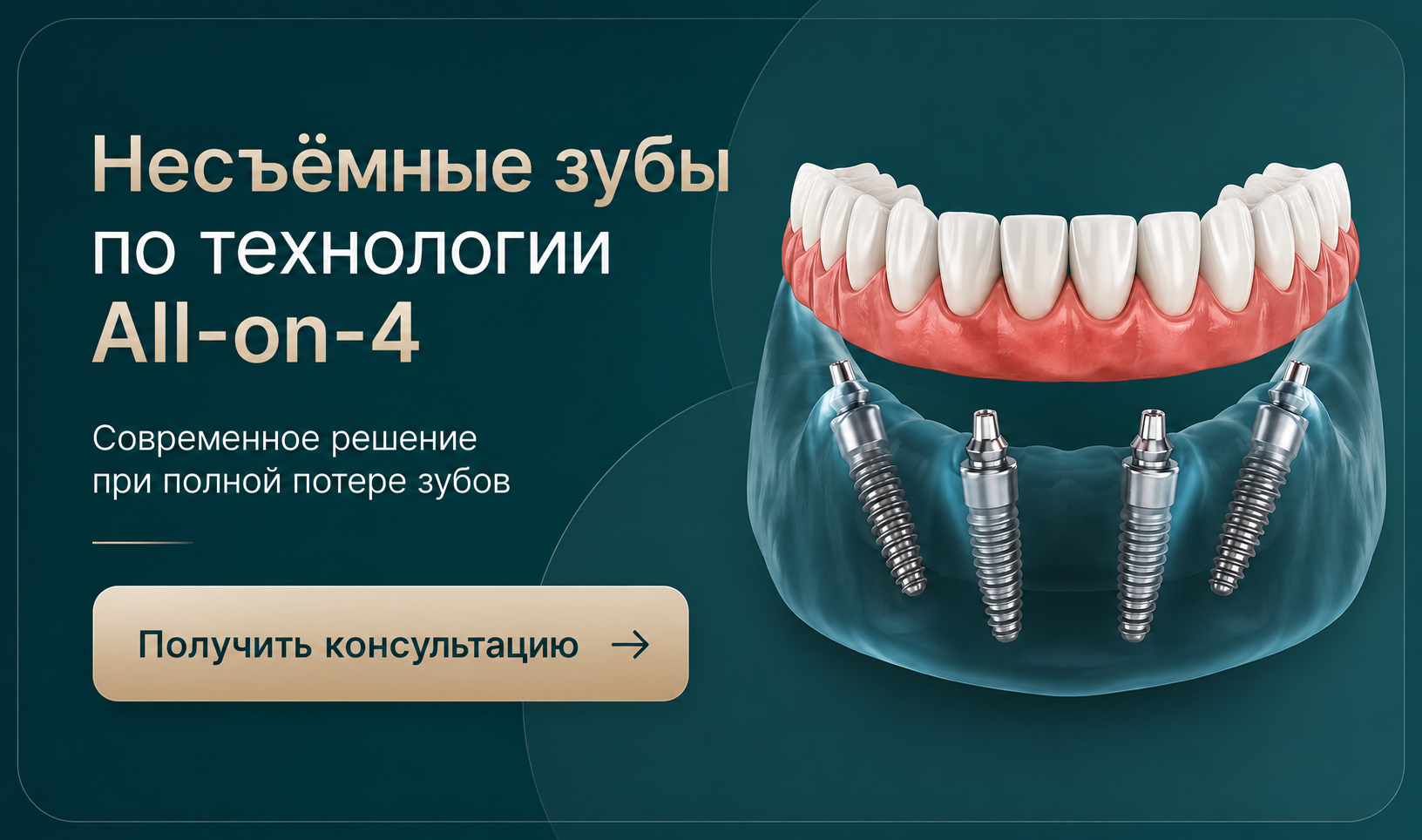 Варианты частичного протезирования зубов